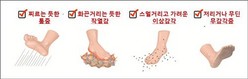 thumbimg